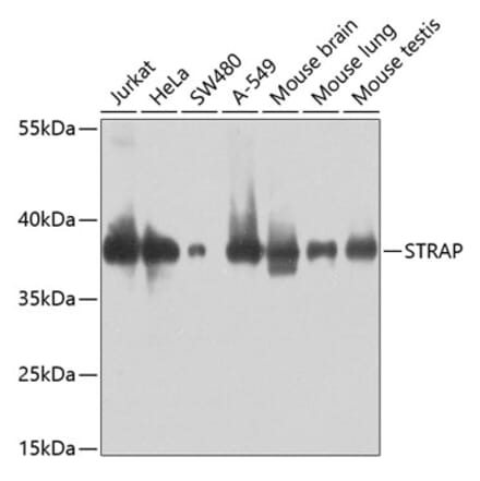 Western Blot - Anti-Unrip Antibody (A306944) - Antibodies.com