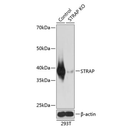 Western Blot - Anti-Unrip Antibody (A306945) - Antibodies.com