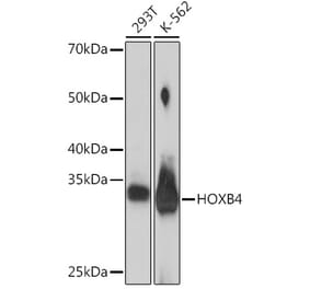 Western Blot - Anti-HOXB4 Antibody [ARC2236] (A306946) - Antibodies.com
