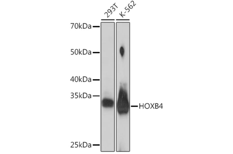 Western Blot - Anti-HOXB4 Antibody [ARC2236] (A306946) - Antibodies.com