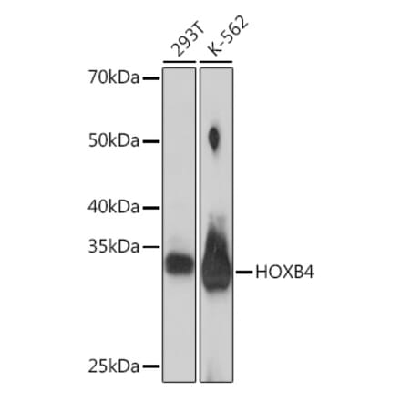 Western Blot - Anti-HOXB4 Antibody [ARC2236] (A306946) - Antibodies.com