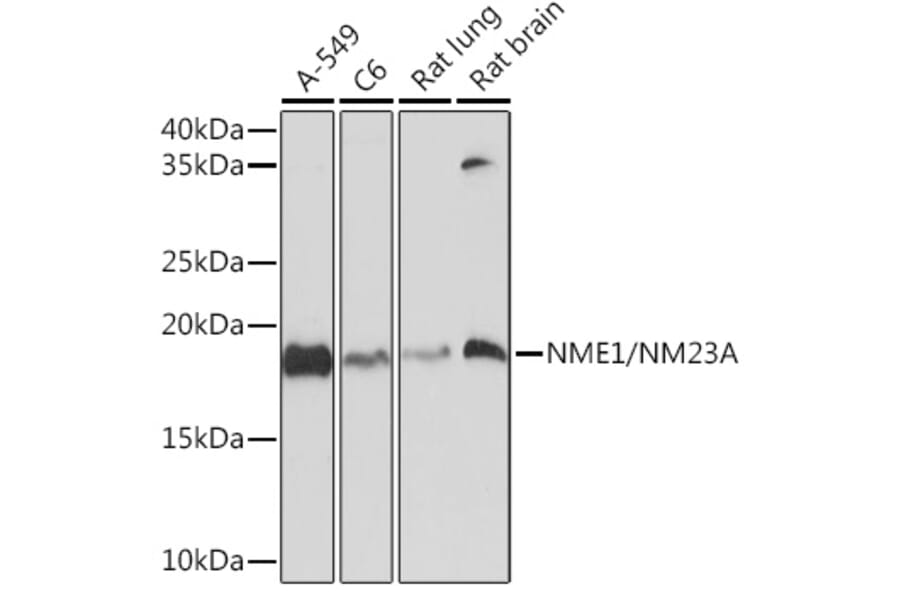 Western Blot - Anti-NM23A Antibody [ARC1309] (A306947) - Antibodies.com