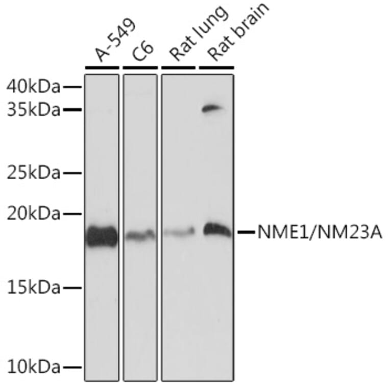 Western Blot - Anti-NM23A Antibody [ARC1309] (A306947) - Antibodies.com
