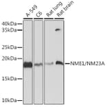 Western Blot - Anti-NM23A Antibody [ARC1309] (A306947) - Antibodies.com