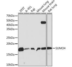 Western Blot - Anti-Sumo4 Antibody [ARC1382] (A306949) - Antibodies.com
