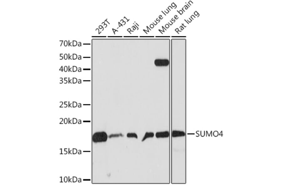 Western Blot - Anti-Sumo4 Antibody [ARC1382] (A306949) - Antibodies.com