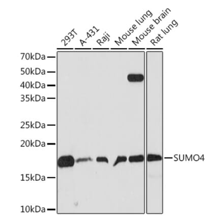 Western Blot - Anti-Sumo4 Antibody [ARC1382] (A306949) - Antibodies.com