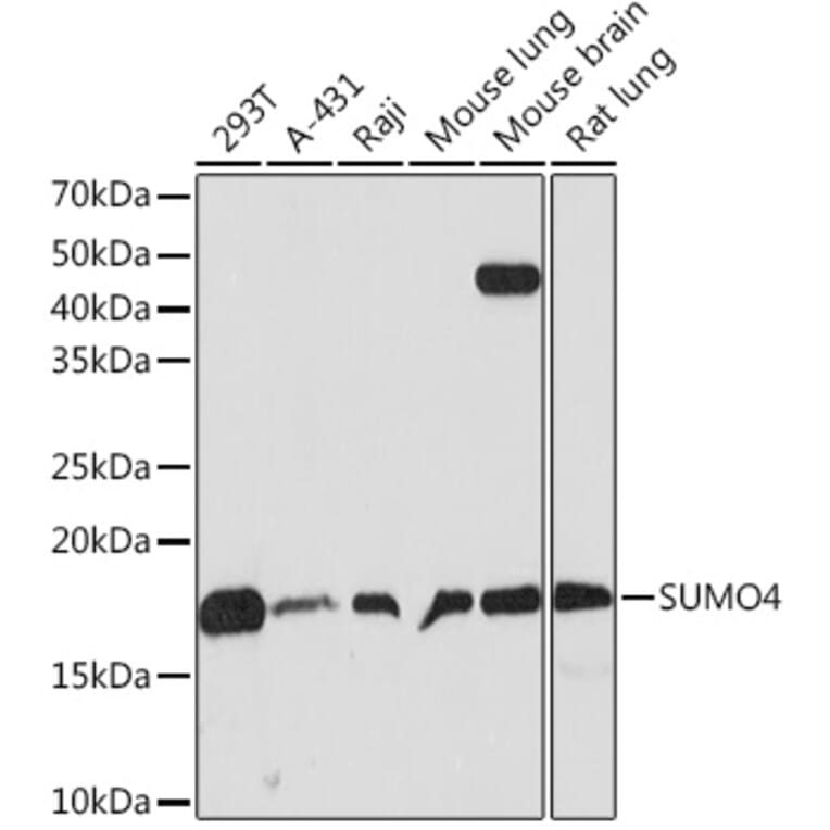 Western Blot - Anti-Sumo4 Antibody [ARC1382] (A306949) - Antibodies.com