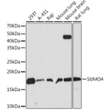 Western Blot - Anti-Sumo4 Antibody [ARC1382] (A306949) - Antibodies.com