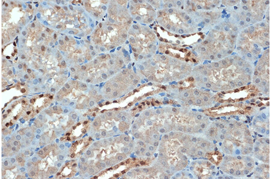 Immunohistochemistry - Anti-Sumo4 Antibody [ARC1382] (A306949) - Antibodies.com