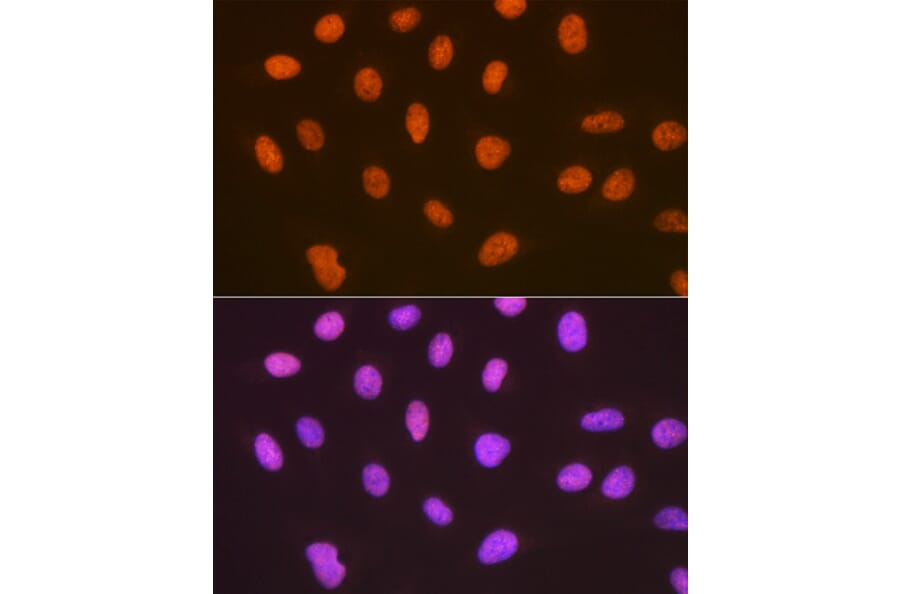 Immunofluorescence - Anti-Sumo4 Antibody [ARC1382] (A306949) - Antibodies.com