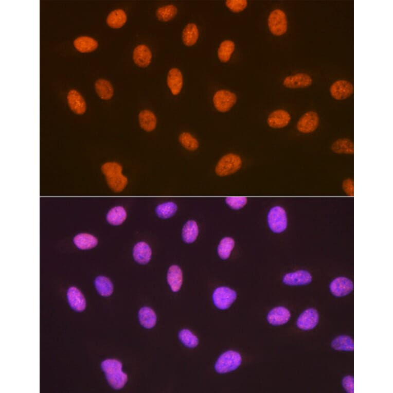 Immunofluorescence - Anti-Sumo4 Antibody [ARC1382] (A306949) - Antibodies.com