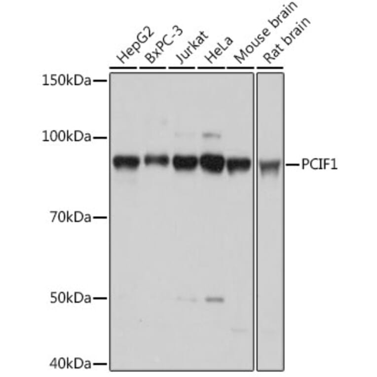 Western Blot - Anti-PCIF1 Antibody (A306951) - Antibodies.com