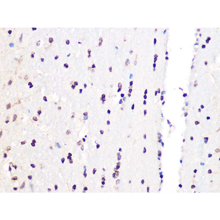 Immunohistochemistry - Anti-PCIF1 Antibody (A306951) - Antibodies.com