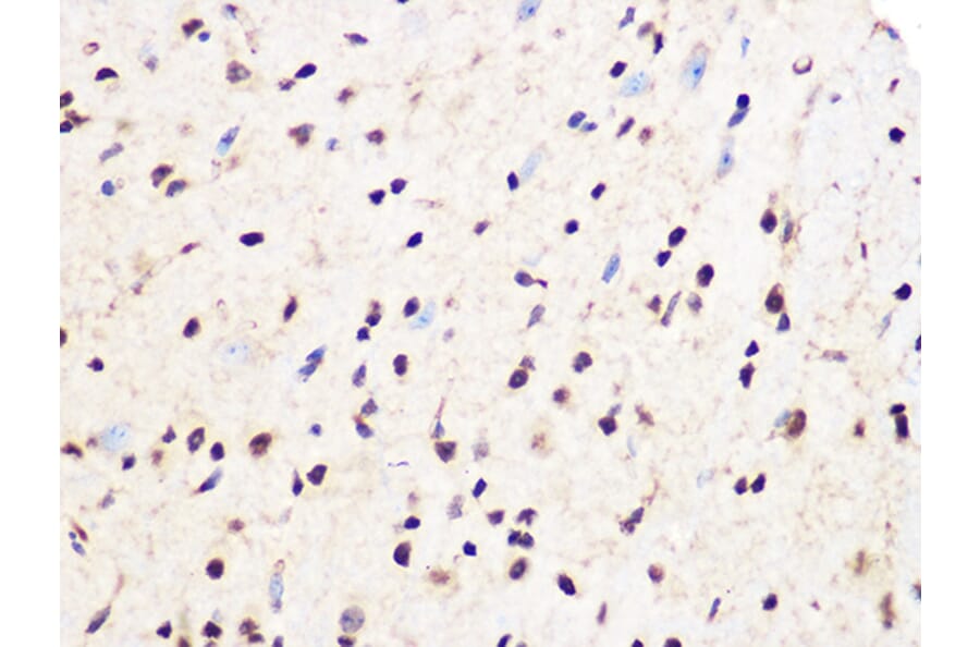 Immunohistochemistry - Anti-PCIF1 Antibody (A306951) - Antibodies.com
