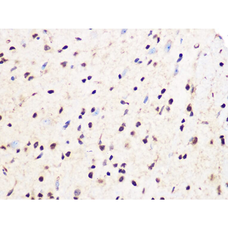 Immunohistochemistry - Anti-PCIF1 Antibody (A306951) - Antibodies.com