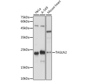 Western Blot - Anti-TAGLN2 Antibody (A306954) - Antibodies.com