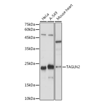 Western Blot - Anti-TAGLN2 Antibody (A306954) - Antibodies.com
