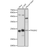 Western Blot - Anti-TAGLN2 Antibody (A306954) - Antibodies.com