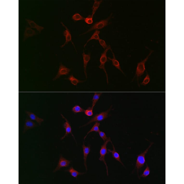 Immunofluorescence - Anti-TAGLN2 Antibody (A306954) - Antibodies.com