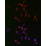 Immunofluorescence - Anti-TAGLN2 Antibody (A306954) - Antibodies.com