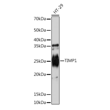 Western Blot - Anti-TIMP1 Antibody [ARC1195] (A306955) - Antibodies.com