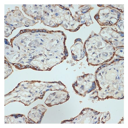 Immunohistochemistry - Anti-Placental lactogen Antibody [ARC2426] (A306956) - Antibodies.com