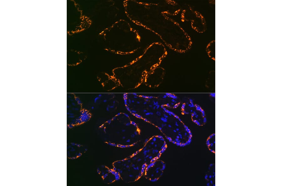 Immunofluorescence - Anti-Placental lactogen Antibody [ARC2426] (A306956) - Antibodies.com