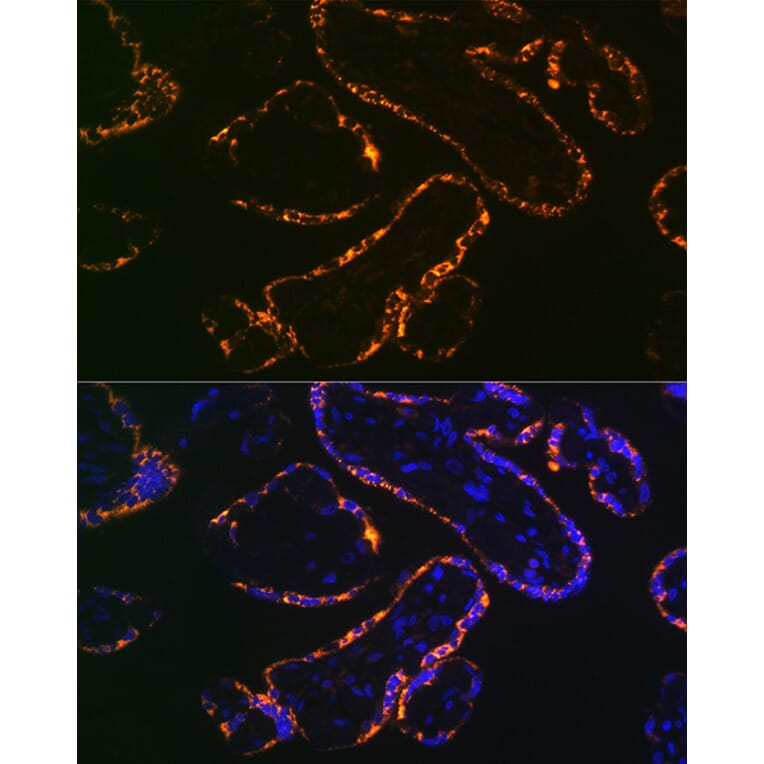 Immunofluorescence - Anti-Placental lactogen Antibody [ARC2426] (A306956) - Antibodies.com