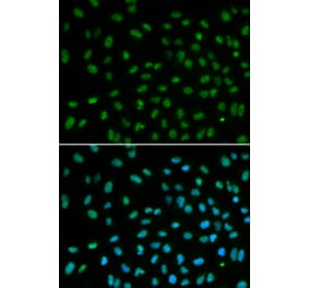 Immunofluorescence - Anti-DDB2 Antibody (A306959) - Antibodies.com