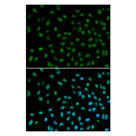 Immunofluorescence - Anti-DDB2 Antibody (A306959) - Antibodies.com
