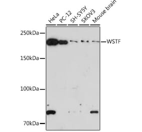 Western Blot - Anti-WSTF Antibody [ARC1614] (A306961) - Antibodies.com