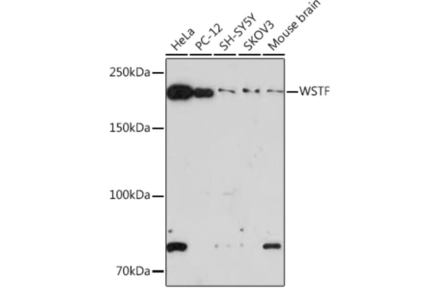 Western Blot - Anti-WSTF Antibody [ARC1614] (A306961) - Antibodies.com