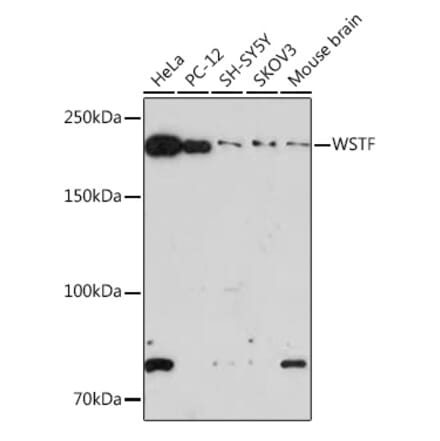 Western Blot - Anti-WSTF Antibody [ARC1614] (A306961) - Antibodies.com