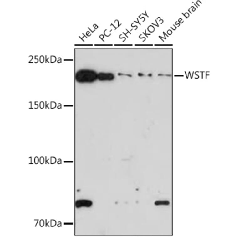Western Blot - Anti-WSTF Antibody [ARC1614] (A306961) - Antibodies.com