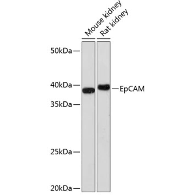 Western Blot - Anti-EpCAM Antibody [ARC0521] (A306962) - Antibodies.com