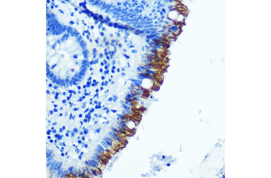 Immunohistochemistry - Anti-EpCAM Antibody [ARC0521] (A306962) - Antibodies.com
