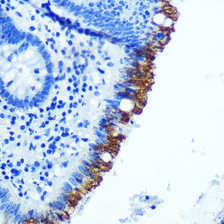 Immunohistochemistry - Anti-EpCAM Antibody [ARC0521] (A306962) - Antibodies.com