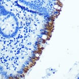 Immunohistochemistry - Anti-EpCAM Antibody [ARC0521] (A306962) - Antibodies.com