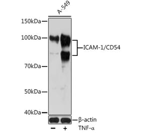 Western Blot - Anti-ICAM1 Antibody [ARC0261] (A306965) - Antibodies.com