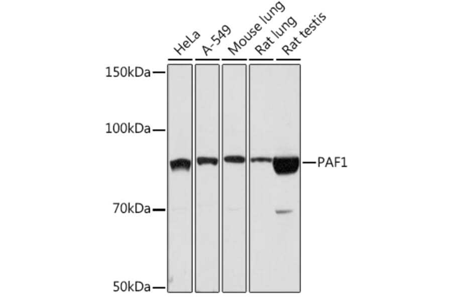 Western Blot - Anti-PAF1/PD2 Antibody [ARC2019] (A306966) - Antibodies.com