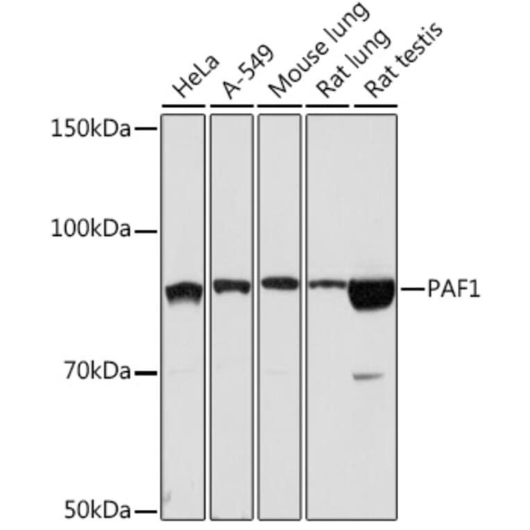 Western Blot - Anti-PAF1/PD2 Antibody [ARC2019] (A306966) - Antibodies.com