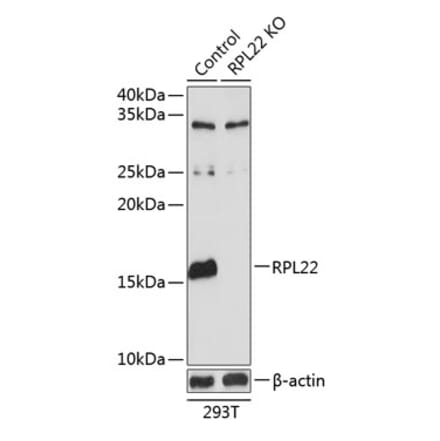 Western Blot - Anti-RPL22 Antibody (A306967) - Antibodies.com