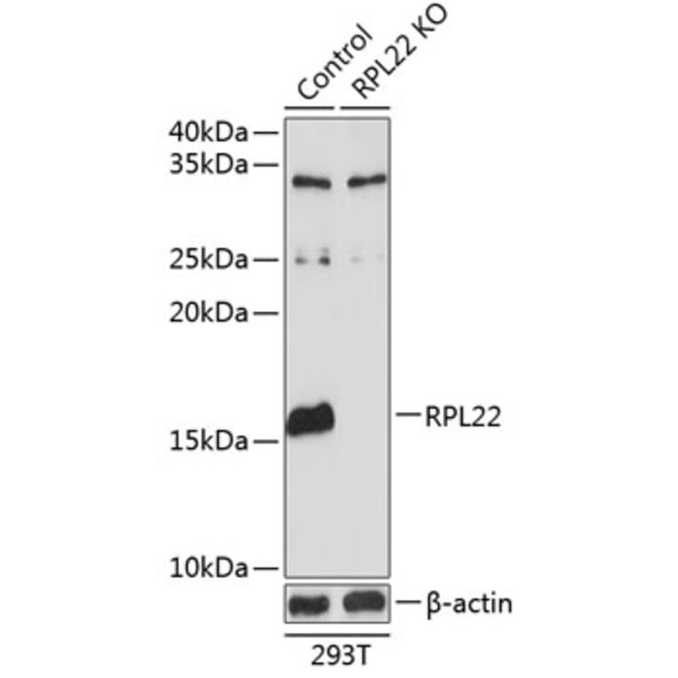 Western Blot - Anti-RPL22 Antibody (A306967) - Antibodies.com
