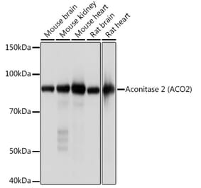 Western Blot - Anti-Aconitase 2 Antibody [ARC1072] (A306968) - Antibodies.com