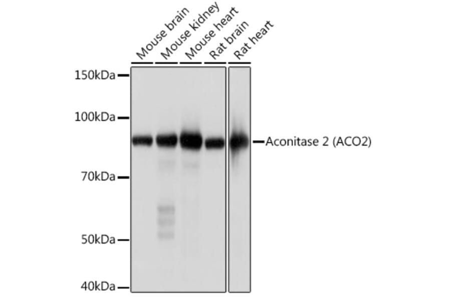 Western Blot - Anti-Aconitase 2 Antibody [ARC1072] (A306968) - Antibodies.com