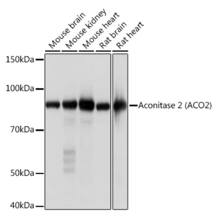 Western Blot - Anti-Aconitase 2 Antibody [ARC1072] (A306968) - Antibodies.com