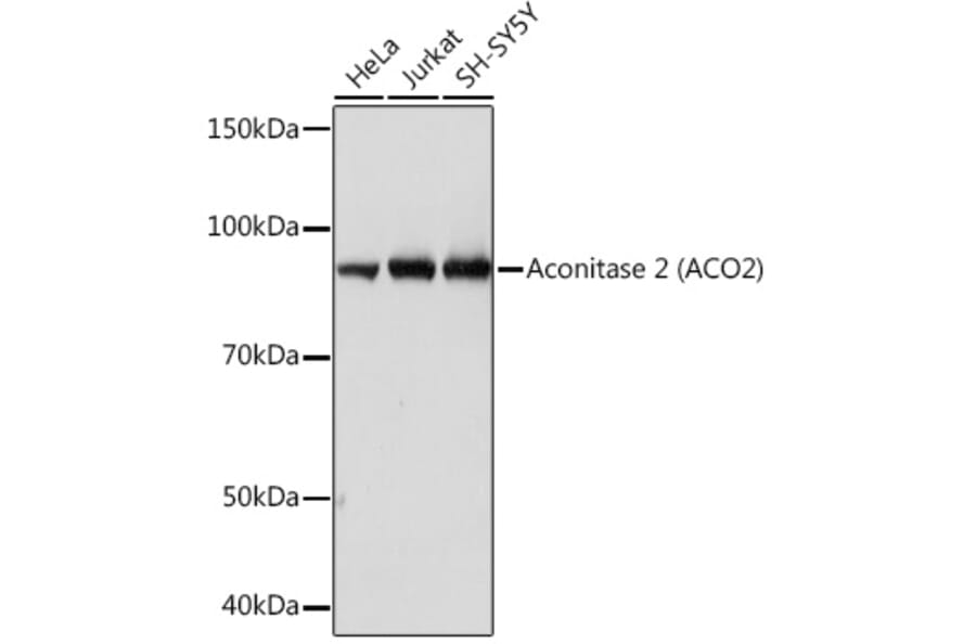 Western Blot - Anti-Aconitase 2 Antibody [ARC1072] (A306968) - Antibodies.com