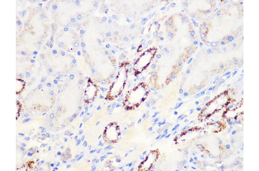 Immunohistochemistry - Anti-Aconitase 2 Antibody [ARC1072] (A306968) - Antibodies.com