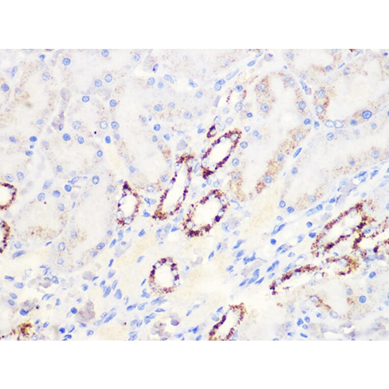 Immunohistochemistry - Anti-Aconitase 2 Antibody [ARC1072] (A306968) - Antibodies.com